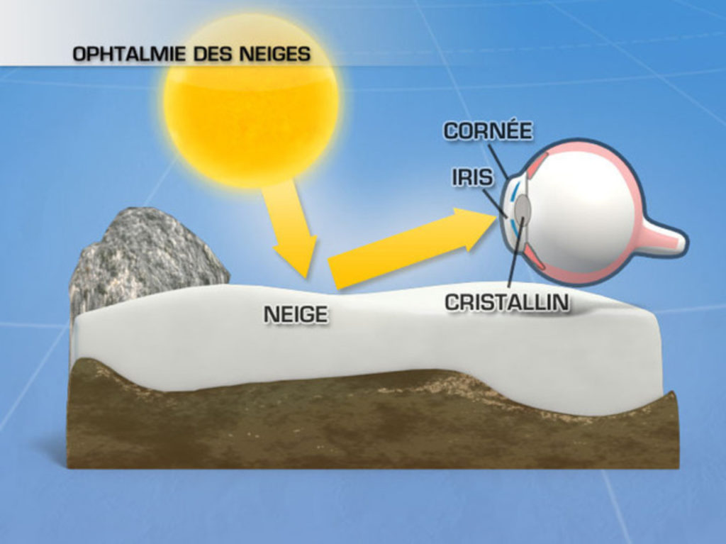 La cause du soleil à la montagne